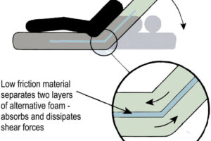 Align-Mattress-ENG-1-graph